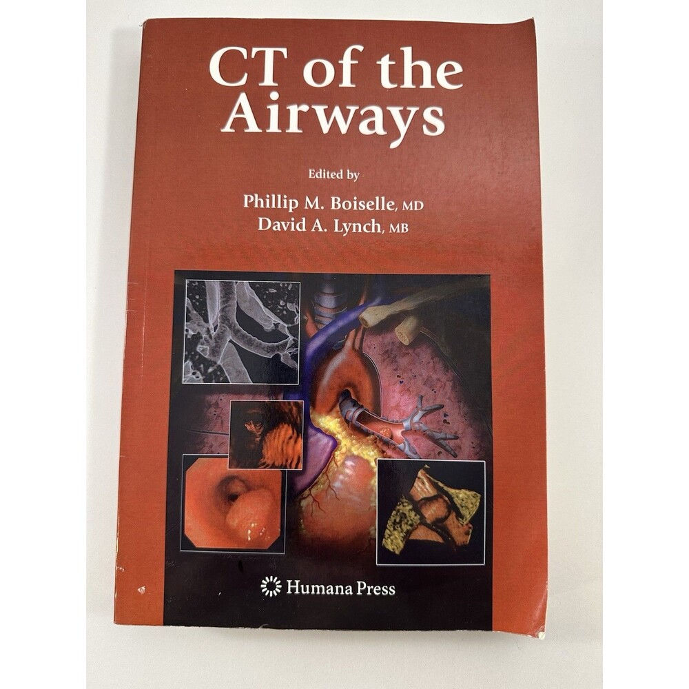 CT Of The Airways Edited By Phillip M Boiselle MD David A Lynch MB Paperback